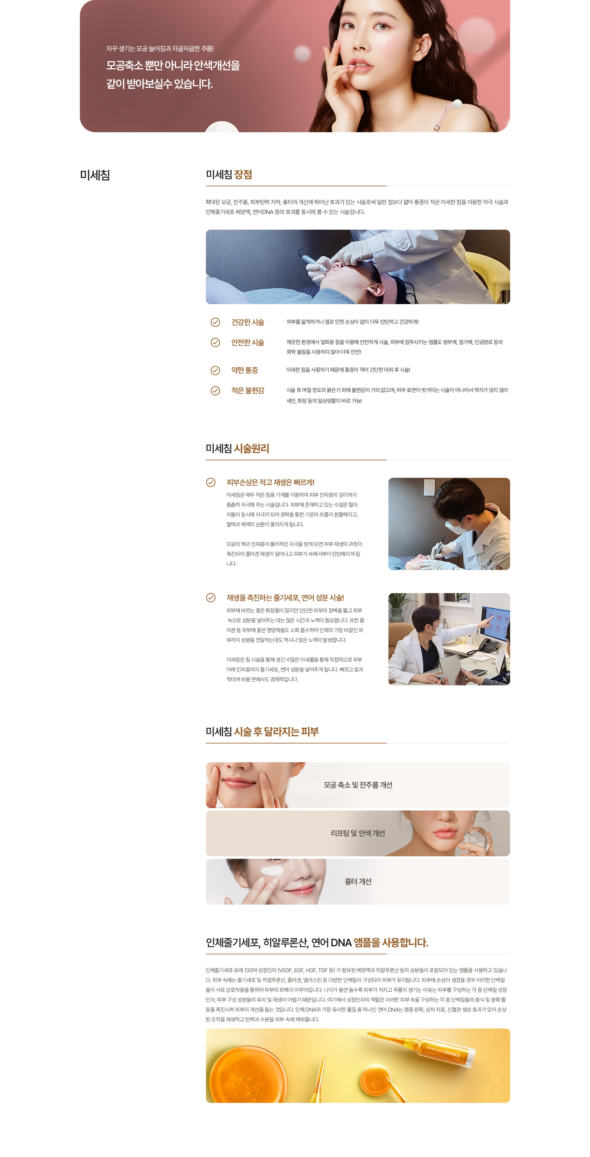 미세침, 청안침, 동안침 내용